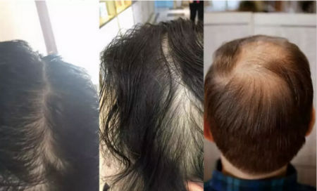 唯拾壹跨境美妝|我缺的不是卷發(fā)棒！不是錢！是頭發(fā)啊