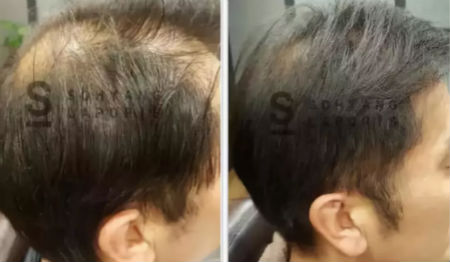 唯拾壹跨境美妝|我缺的不是卷發(fā)棒！不是錢！是頭發(fā)啊