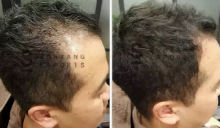 唯拾壹跨境美妝|我缺的不是卷發(fā)棒！不是錢！是頭發(fā)啊