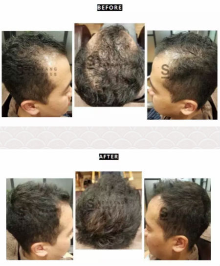 唯拾壹|別人脫單你脫發(fā)？樣的頭皮管理能讓你分分鐘開掛！