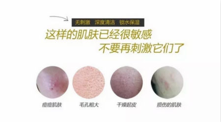 NewNewDIY|敏感肌如何選洗面奶？皮膚科醫生推薦這款！