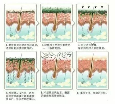 堪稱“換臉”的神奇煥膚術(shù)，你get了嗎？