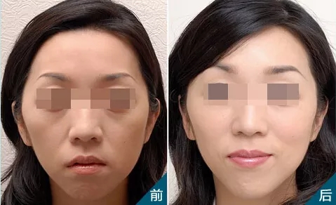 無針?biāo)猓瑧{什么讓女性為之瘋狂和傾倒？！