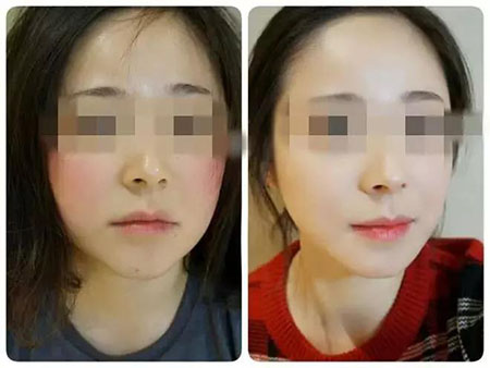 拒絕春季過敏、紅腫、發(fā)癢！敏感肌的救星來啦~