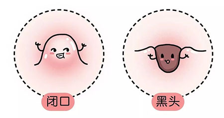 “閉口”這個磨人的小妖精又出來作妖啦！