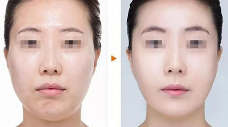 水氧活膚—“氧”出好氣色，打造人見(jiàn)人愛(ài)的水嫩美肌~