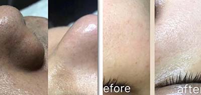 定期做這些美容補(bǔ)水管理，1次好過敷2周面膜