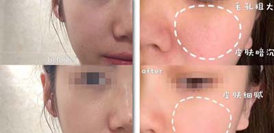 定期做這些美容補(bǔ)水管理，1次好過敷2周面膜