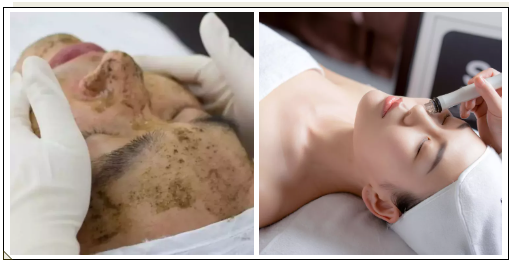 VN美膚經(jīng)：定期做皮膚管理的好處，值得每個(gè)人收藏！