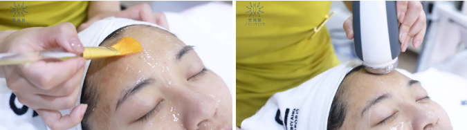 美業掘金內幕｜院線護理“爆品打造”六要素