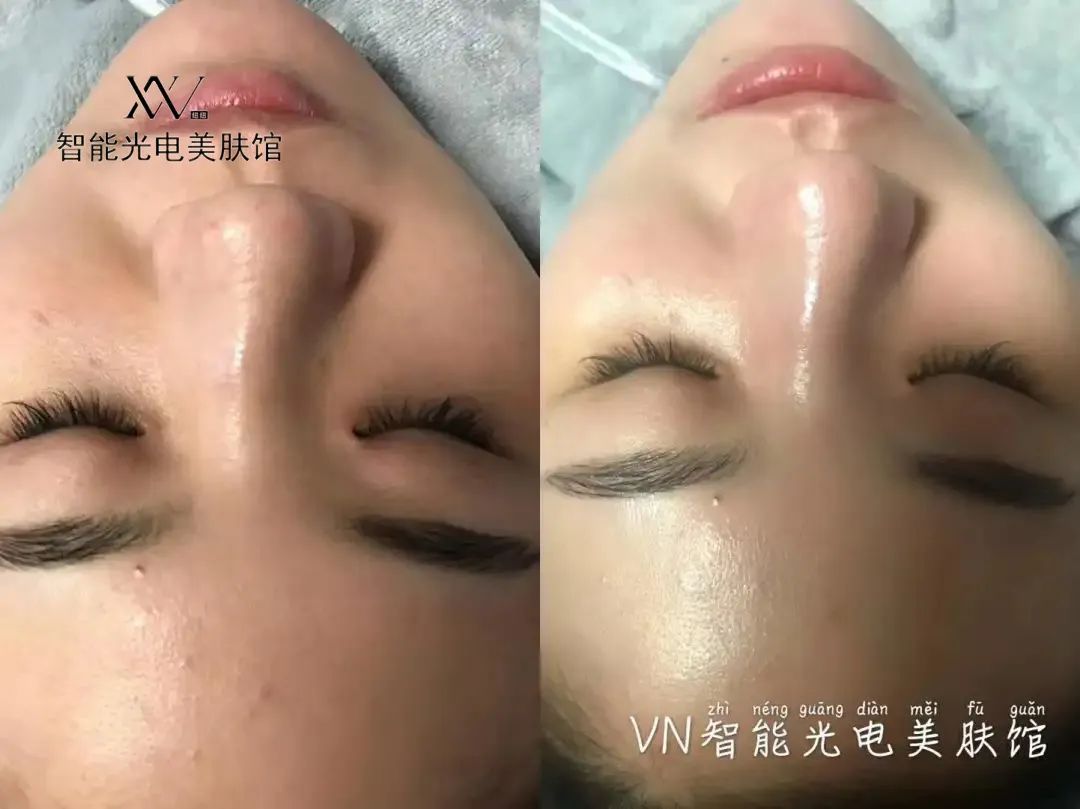 VN美業(yè)運營：掌握這5種需求，顧客追著你買單！