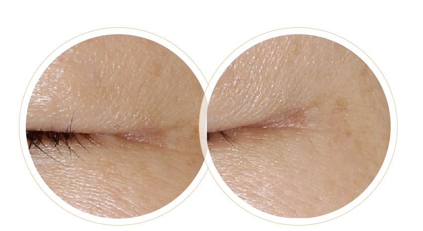 一篇秒懂！為何定期做皮膚管理的人不易老？