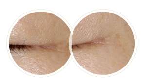 一篇秒懂！為何定期做皮膚管理的人不易老？