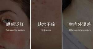 無懼時光，天生優雅，敏感肌&受損肌的修護“膜”法