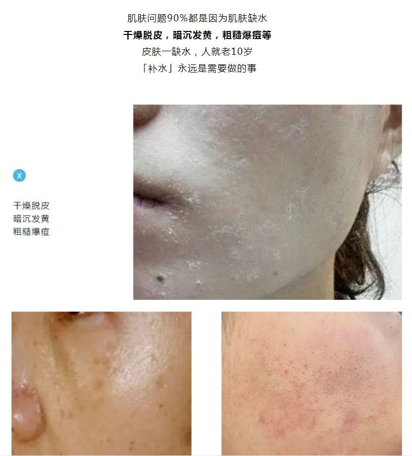 面膜爆品 | 令人艷羨的好皮膚，全靠「補(bǔ)水」